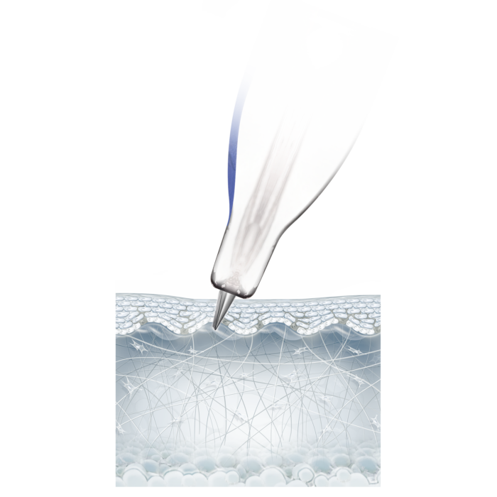 Nanosoft S1